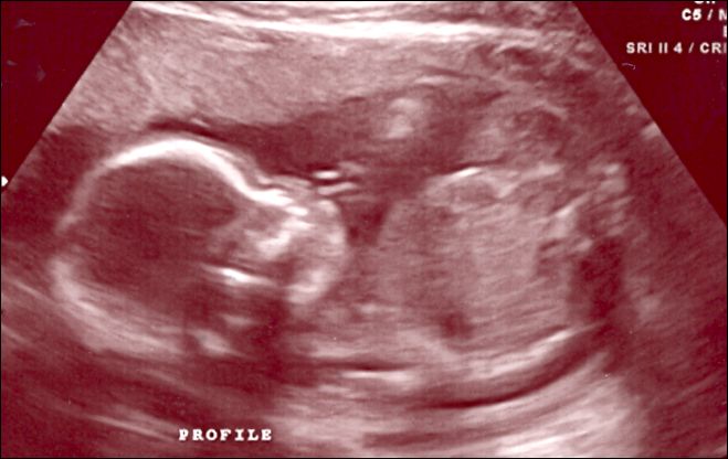 07-2008Sept03a