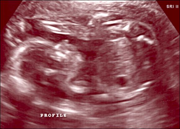 08-2008Sept03b