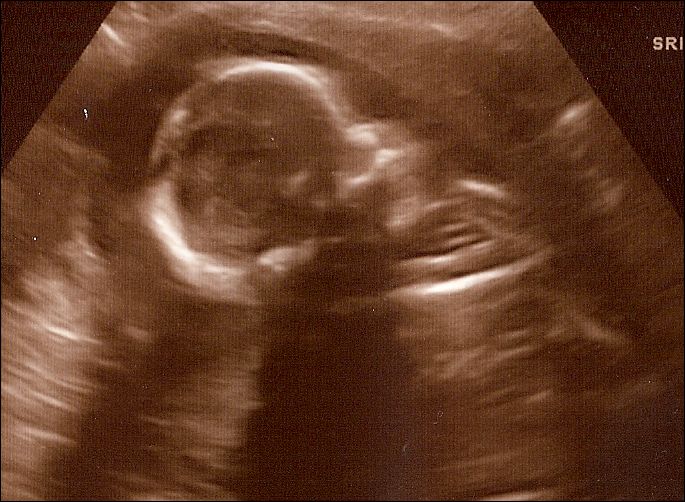 11-2008Sept18b