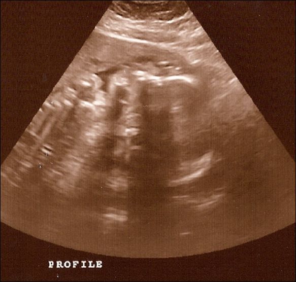 12-2008Oct22a