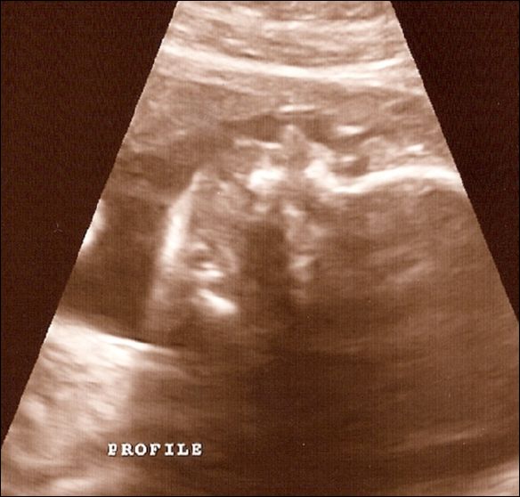 13-2008Oct22b