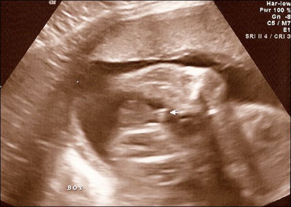 14-2008Oct22c - Still A Boy!